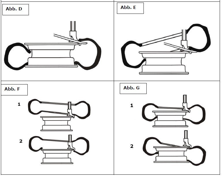 Smontagomme Zipper ZI-RMM95
